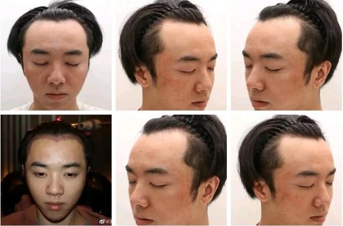 爆料华晨宇整容植发者公开道歉,华晨宇方称拒绝造谣者道歉